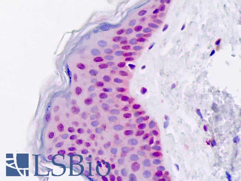 IHC-plus™ DIS3 Antibody (aa295-323)