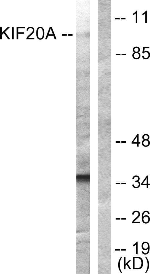 RAB6KIFL / KIF20A Antibody (p528)