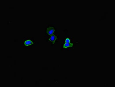 PLIN5 / OXPAT / LSDP5 Antibody
