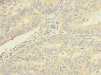 Polyclonal Rabbit anti-Human TMEM56 Antibody