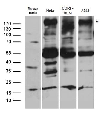 Polyclonal Rabbit anti-Human BAZ1A / ACF1 Antibody (WB)