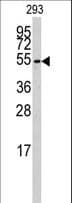CYP26B1 Antibody (aa398-430)