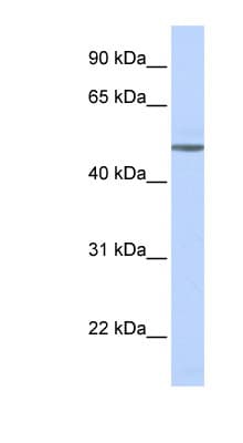 ADRB1 Antibody (aa180-229)