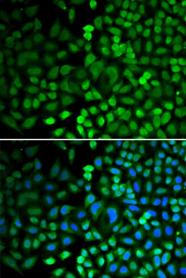 APEX1 / APE1 Antibody