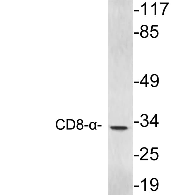 Polyclonal Rabbit anti-Human CD8A / CD8 Alpha Antibody (aa52-101, WB)
