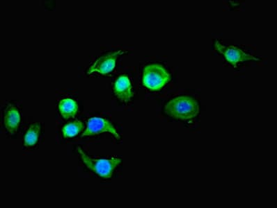 RTN4RL1 / NGRH2 Antibody