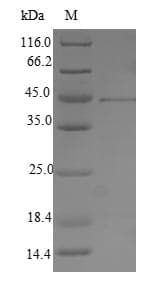 Human gB Protein (Recombinant 6His-SUMO, N-terminus)