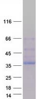 Human NEK6 Protein (Recombinant Myc-DDK (Flag))