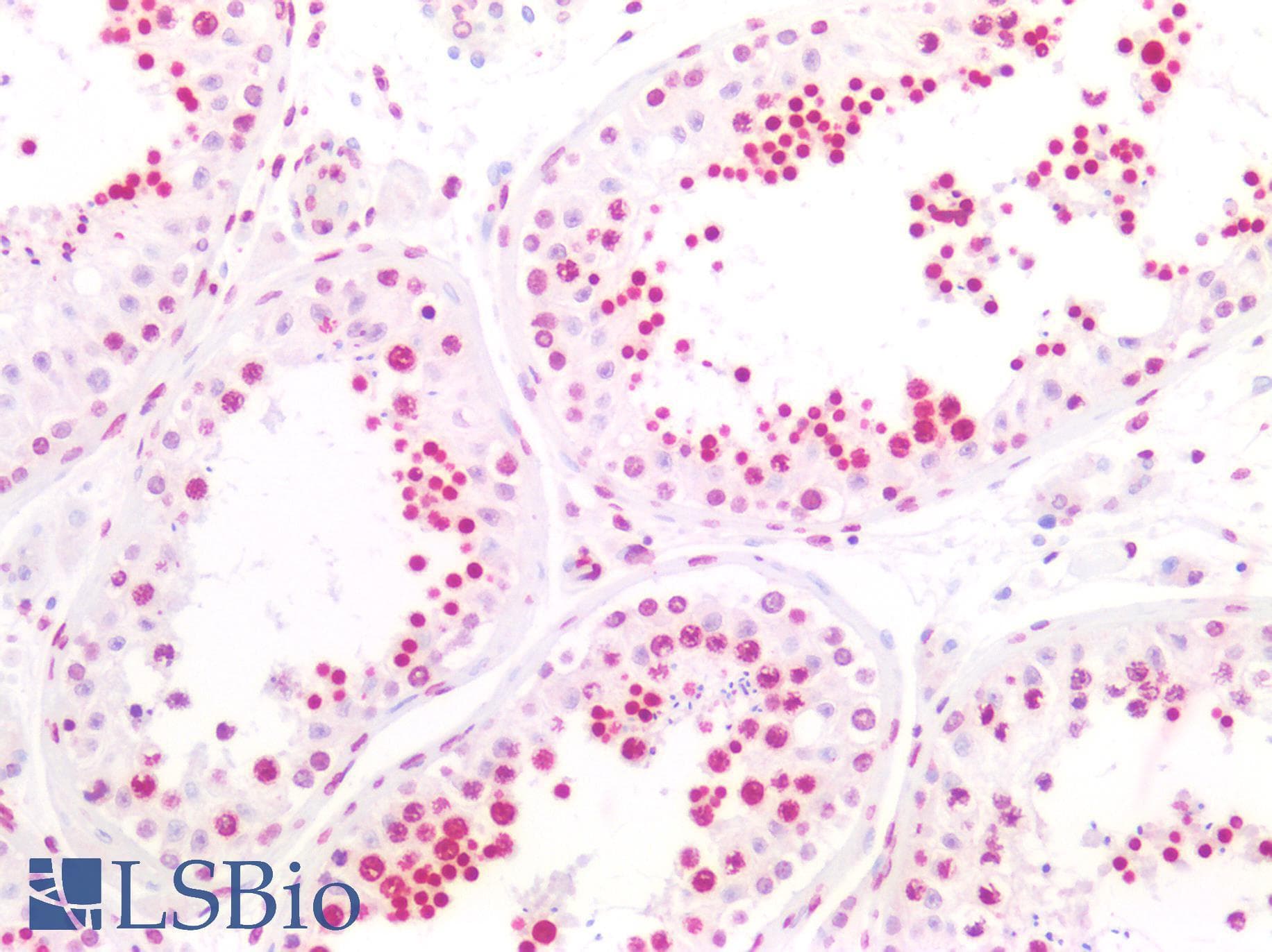 PathPlus™ H2AFX / H2AX Antibody