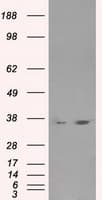 LDHA / LDH1 Antibody (clone OTI5G10)