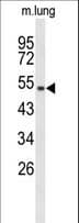 MUTYH / MYH Antibody (aa341-367)
