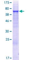 Human UGT3A2 Protein (Recombinant GST)