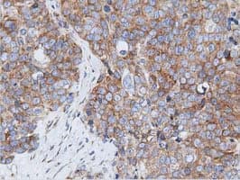 RIT2 / RIN Antibody (clone OTI3F4)