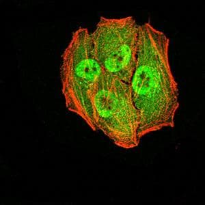 AGR2 Antibody (clone 7H2H7)