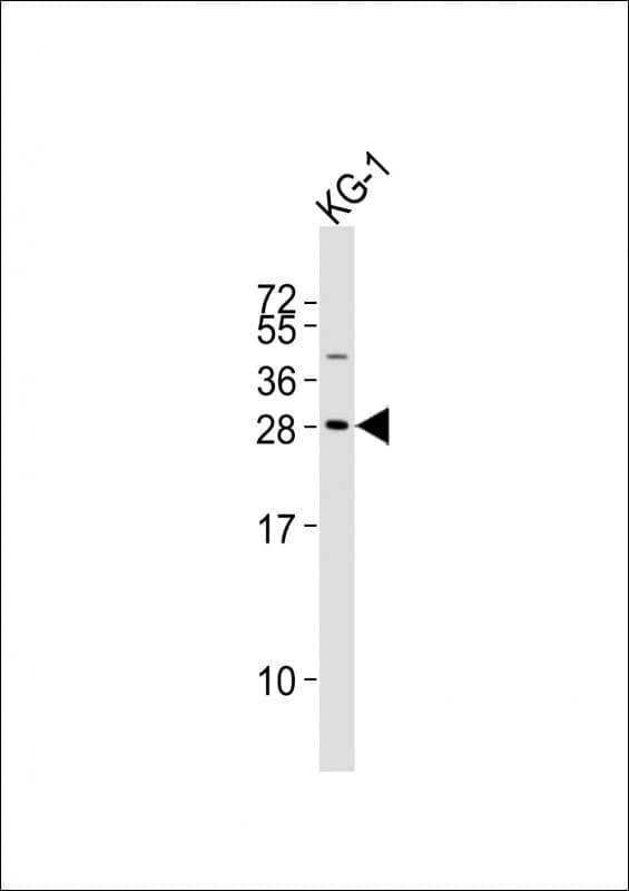 PYCRL Antibody (aa139-171)