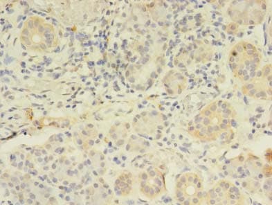 Polyclonal Rabbit anti-Human FKBP11 Antibody (IHC, WB)