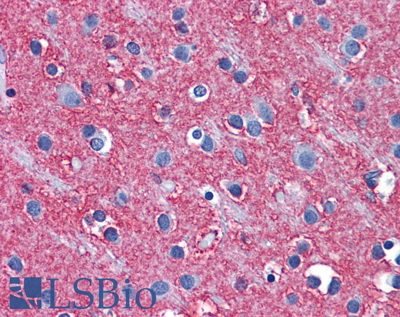 Polyclonal Rabbit anti-Human SLC1A2 / EAAT2 / GLT-1 Antibody (aa467-516, IHC, WB)