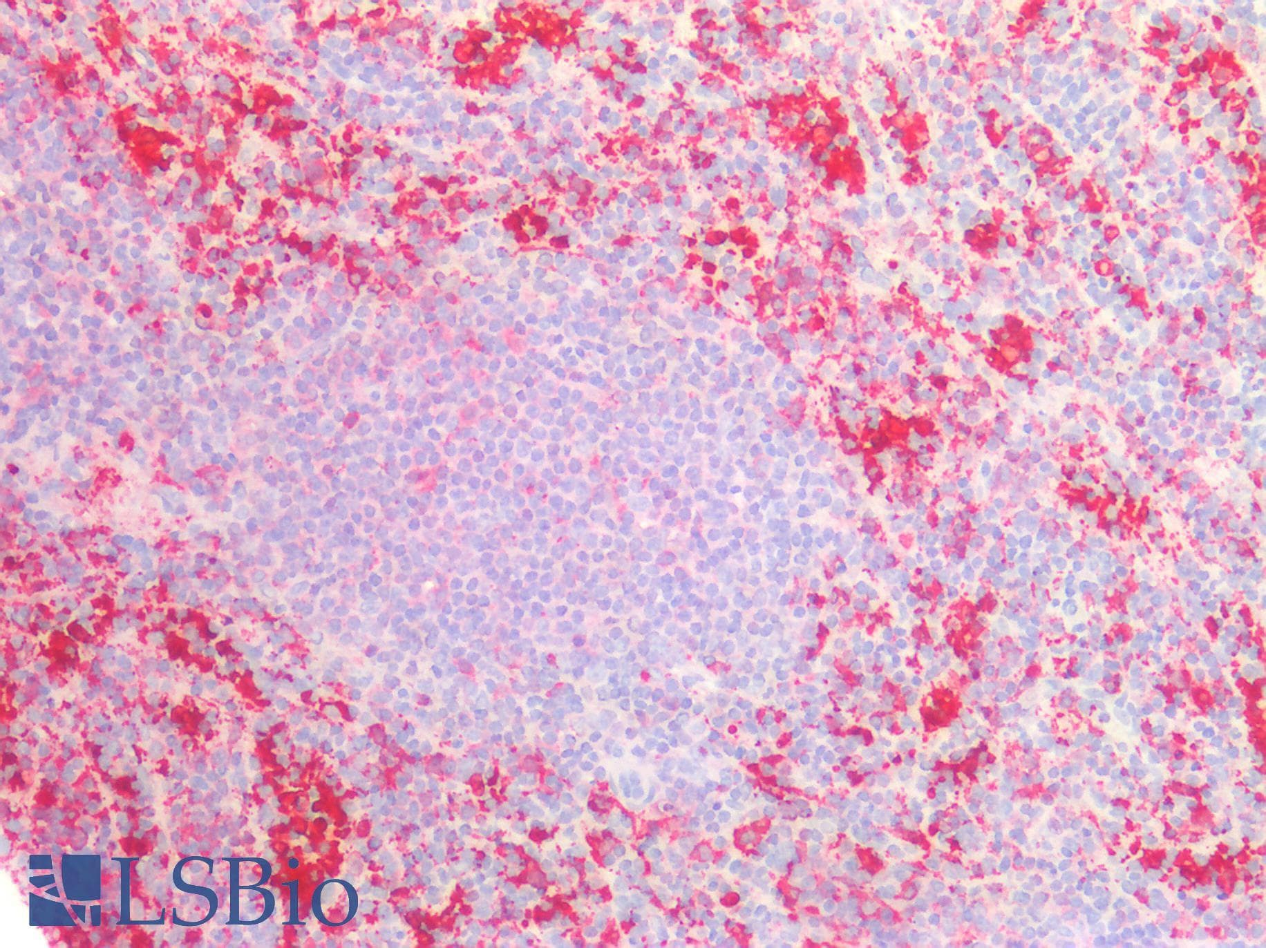 Polyclonal Rabbit anti-Human FTL / Ferritin Light Chain Antibody (IHC, WB)
