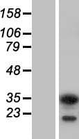 HABT1 / ABT1 Protein (Over-Expression Lysate Myc-DDK (Flag))