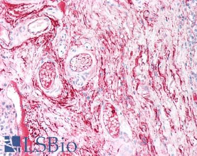 IHC-plus™ Polyclonal Rabbit anti-Human COL5A2 / Collagen V Alpha 2 Antibody (IHC)