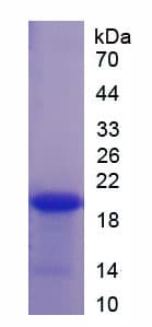 Human NUSAP1 / NUSAP Protein (Recombinant His, N-Terminal)