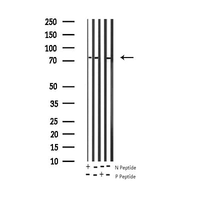 Polyclonal Rabbit anti-Human FOXO1 / FKHR Antibody (phospho-Ser256, IHC, IF, WB)