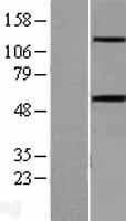 Human ACVR1B / ALK4 Protein (Over-Expression Lysate Myc-DDK (Flag))