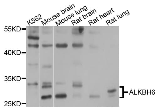 Polyclonal Rabbit anti-Human ALKBH6 Antibody (WB)