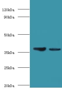 GALM / Mutarotase Antibody (HRP)