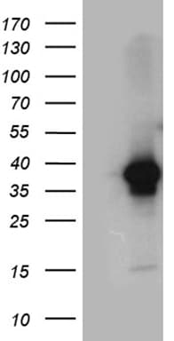 Monoclonal Mouse anti-Human DAPP1 / BAM32 Antibody (clone OTI7D4, Carrier-free, IHC, WB)