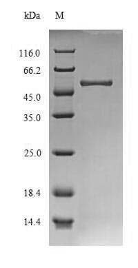 Schizosaccharomyces pombe AGN1 (S. pombe) Protein (Recombinant 10His, N-terminus + Myc, C-terminus)