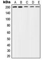 Tuberin / TSC2 Antibody (phospho-Thr1462)