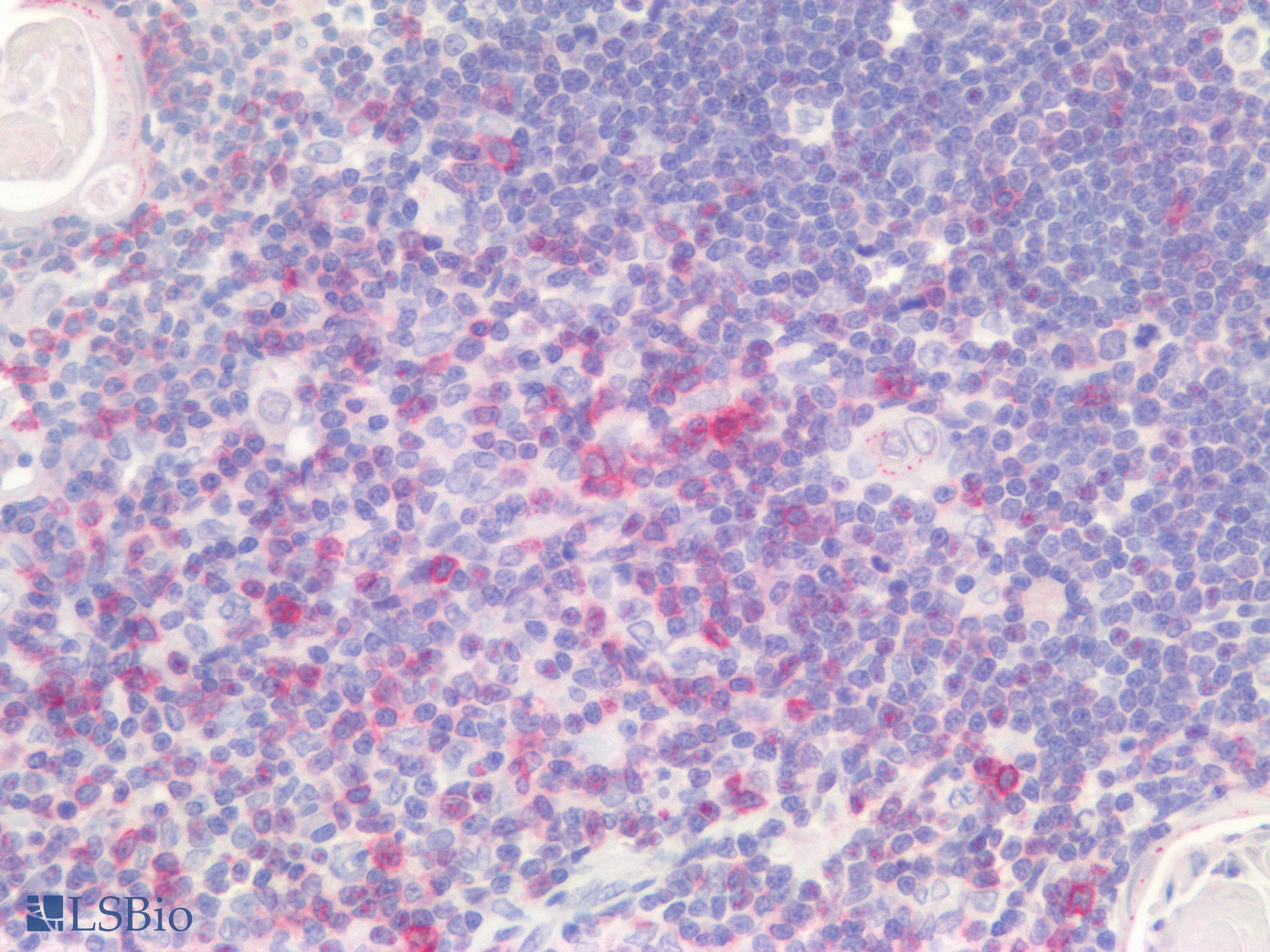 PathPlus™ PDCD1 / CD279 / PD-1 Antibody (clone AHC0211)
