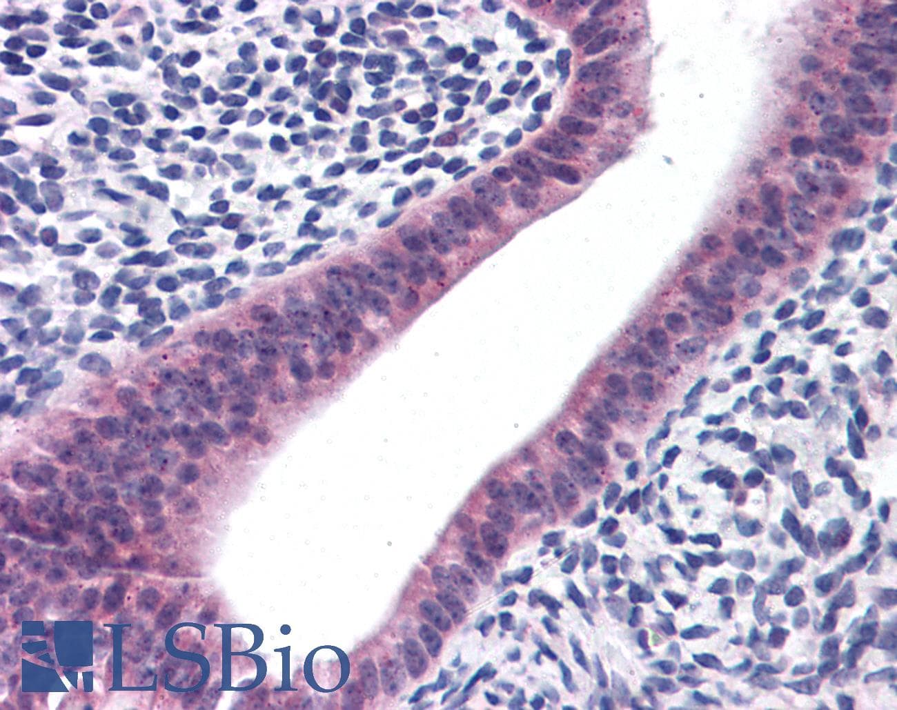 IHC-plus™ PTCHD2 Antibody