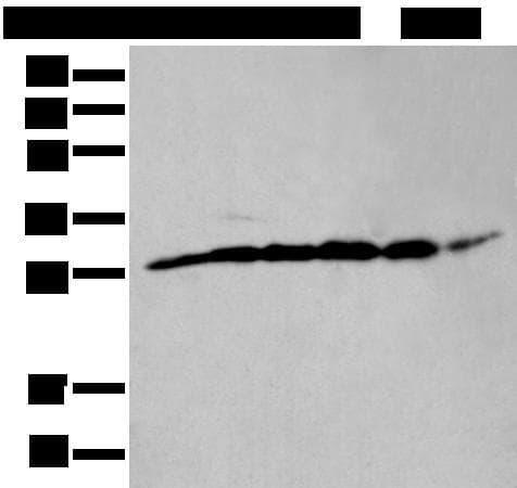 ETFB Antibody