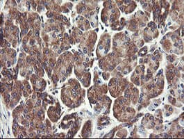 UBE2J1 Antibody (clone OTI3D1)