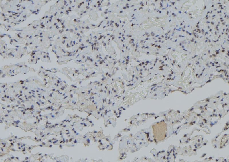 PJA1 / PRAJA1 Antibody