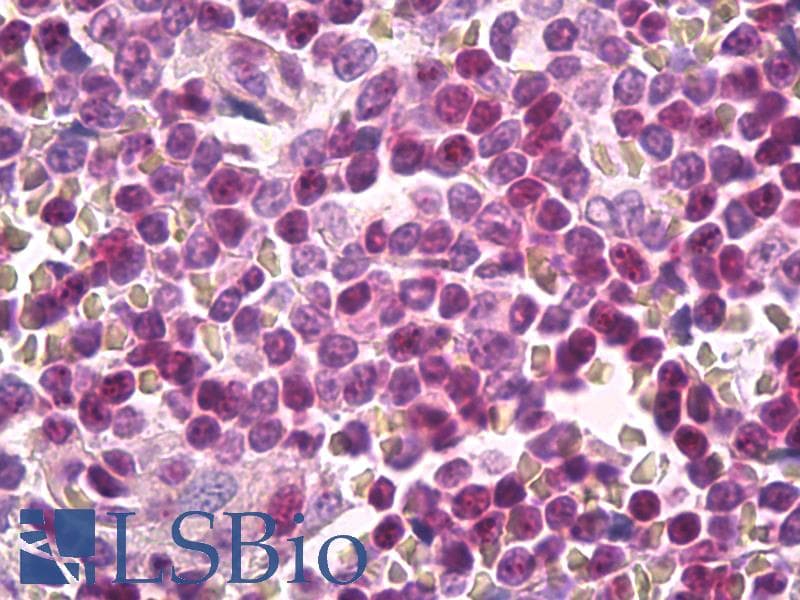 IHC-plus™ Polyclonal Rabbit anti-Human CKS1B / CKS1 Antibody (C-Terminus, IHC, WB)