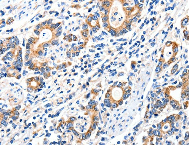 Polyclonal Rabbit anti-Human GRIA2 / GLUR2 Antibody (IHC)