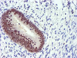 Monoclonal Mouse anti-Human PDSS2 / DLP1 Antibody (clone OTI1D2, IHC, WB)