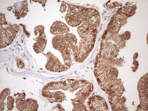 Vps60 / CHMP5 Antibody (clone OTI2E6)