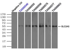 SLC2A5 / GLUT5 Antibody (clone OTI2C4)