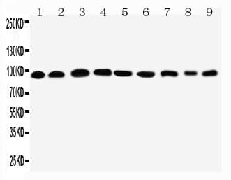 PKP2 / Plakophilin 2 Antibody (aa863-881)