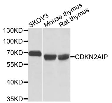 Polyclonal Rabbit anti-Human CDKN2AIP Antibody (WB)