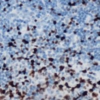 Polyclonal Rabbit anti-Human ETS1 / ETS-1 Antibody (IHC, WB)
