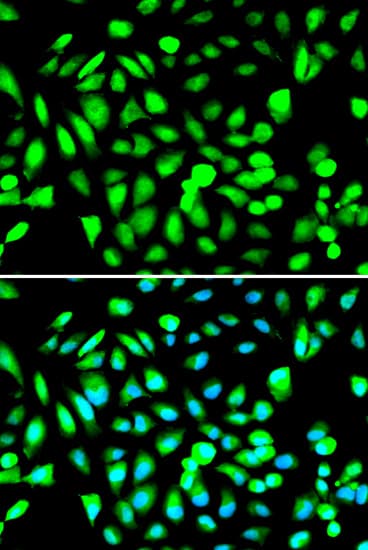 PRMT5 Antibody