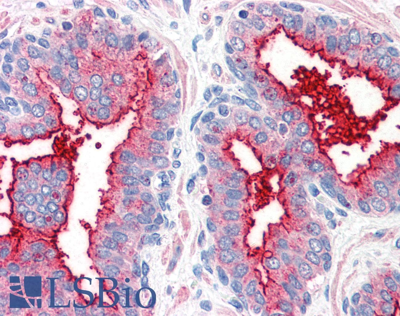 IHC-plus™ Polyclonal Rabbit anti-Human DPP4 / CD26 Antibody (Internal, IHC)
