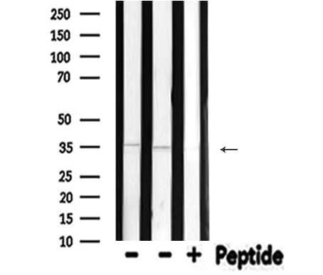 NEUROD1 Antibody