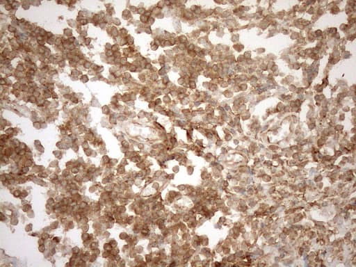 POU2AF1 / BOB1 Antibody (clone OTI13G1)