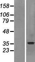 Human SLC10A2 / ASBT Protein (Over-Expression Lysate Myc-DDK (Flag))
